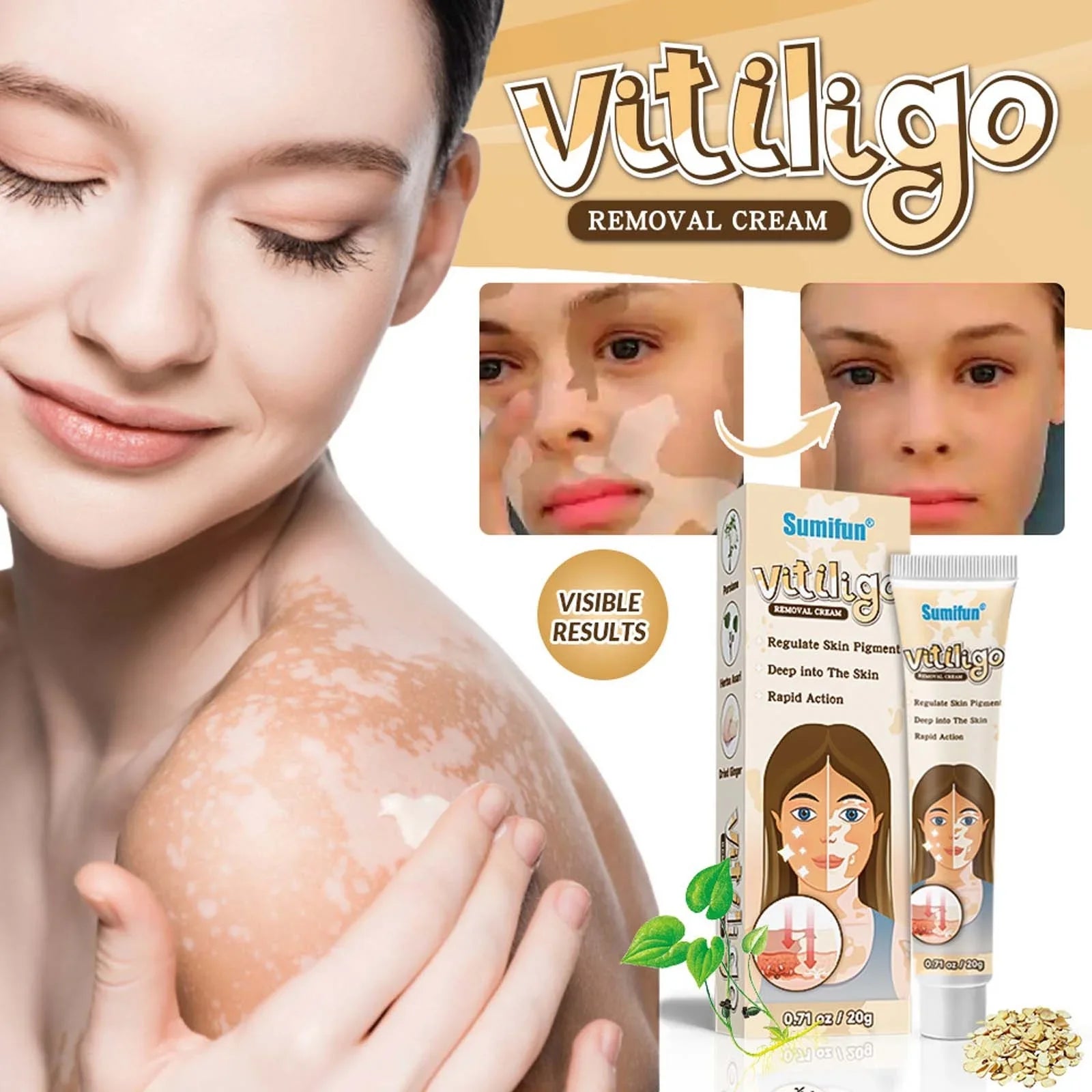 SUMIFUN VITILIGO CREMA ELIMINADORA 20g